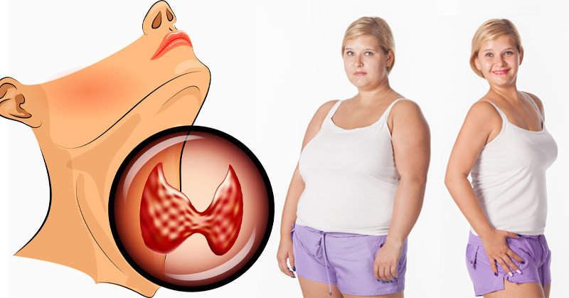 The Best Way To Lose Weight With Hypothyroidism