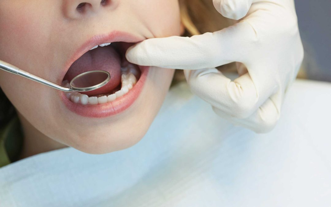 Dental Issues