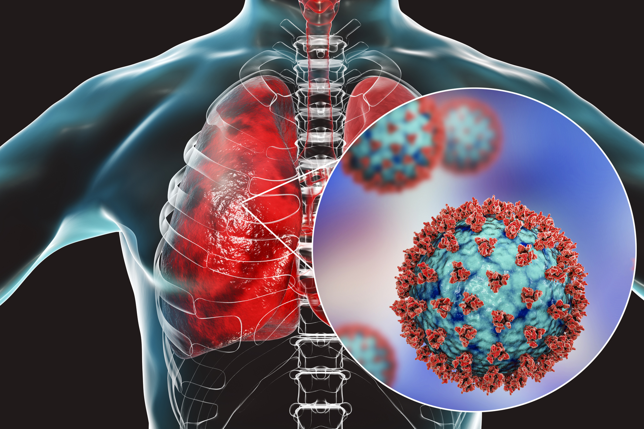 Increased Incidence of Infection