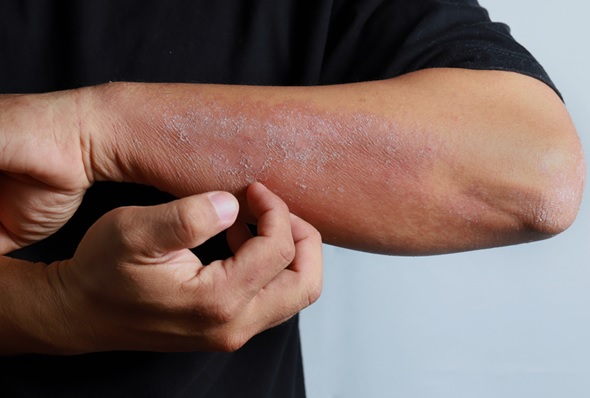 skin problem