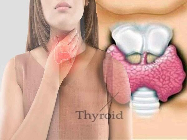 symptoms of thyroid