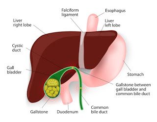 Indian Diet After Gallbladder Removal